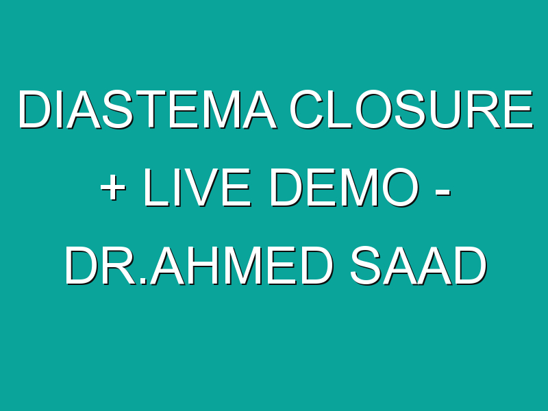Diastema Closure + Live demo – Dr.Ahmed Saad